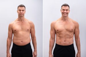 ניתוח קוביות בבטן - לפני ואחרי
